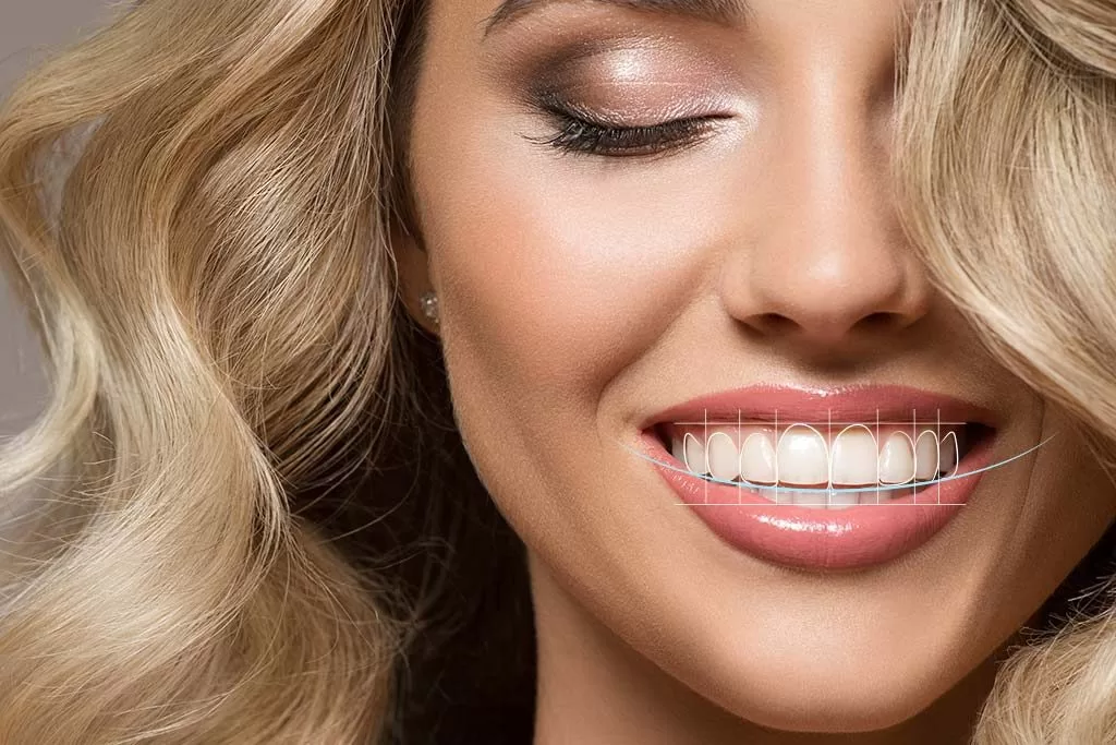 digital smile design